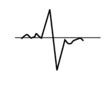 Condenser Microphone Transient
