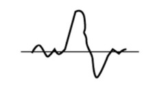 Dynamic Microphone Transient
